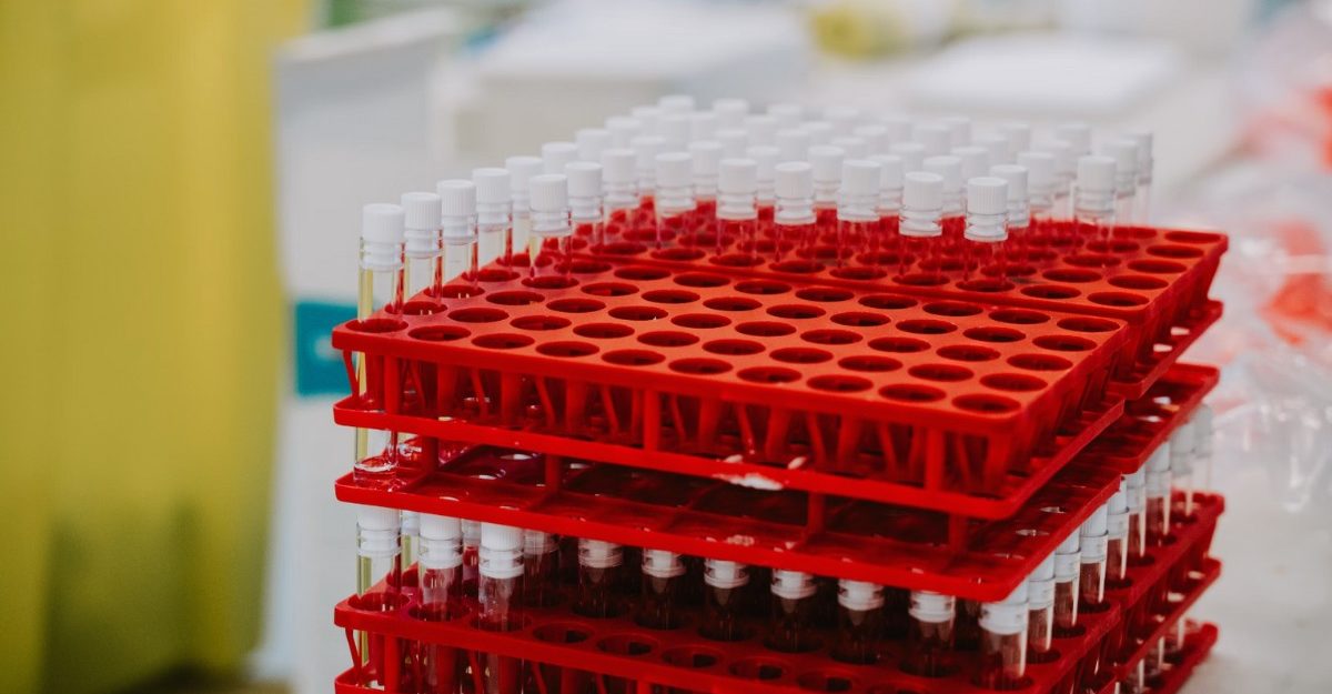 A photo of vials in red containers. (Photo: Mat Napo / Unsplash)