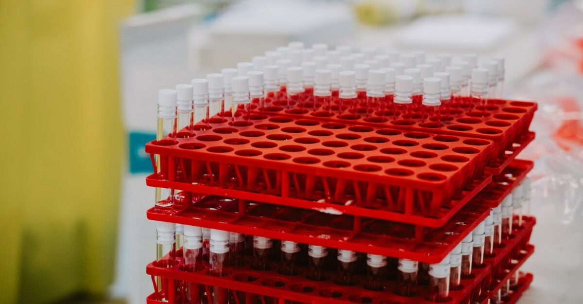 nicoya-acquires-applied-photophysics-rights A photo of vials in red containers. (Photo: Mat Napo / Unsplash)