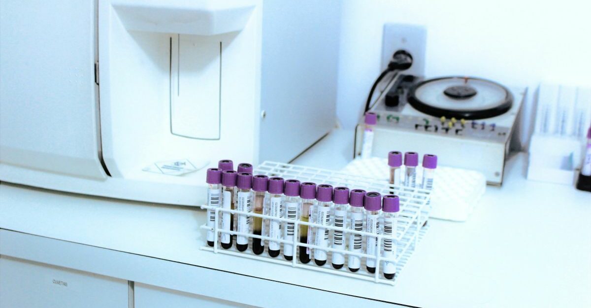 A rack of vials and tubes being processed as part of drug testing in a Canadian workplace.