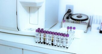 A rack of vials and tubes being processed as part of drug testing in a Canadian workplace.