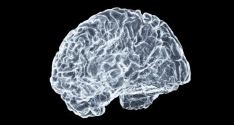 A comprehensive scan of a human brain. (Photo: Shawn Day / Unsplash)