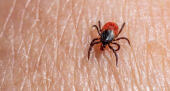 A blacklegged tick on human skin. (Photo: Erik Karits / Unsplash)